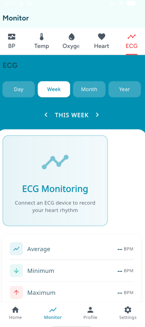 VitalXCare app ECG heart rhythm monitor - 6-lead electrocardiogram with arrhythmia detection